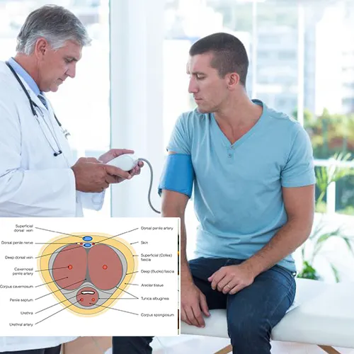Why Choose   Urologist Houston

for Penile Implant Services?