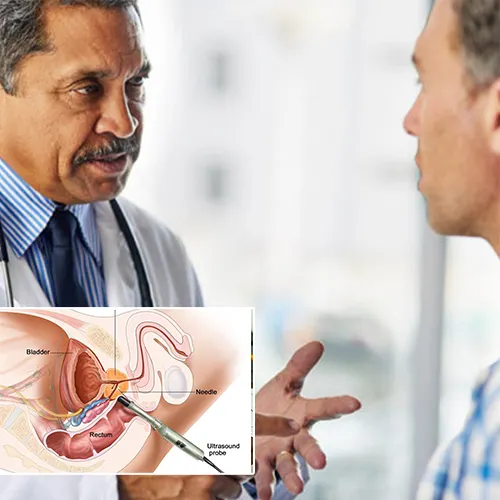 Welcome to Urologist Houston


: Your Destination for Expert Penile Implant Surgery