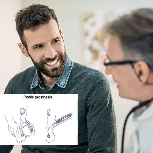 A Step-by-Step Guide to Penile Implant Surgery at Urologist Houston