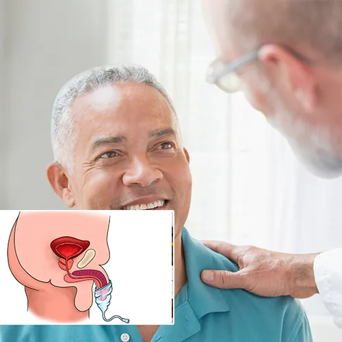 The Penile Implant Procedure: A Gateway to Renewed Intimacy